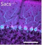 “A mitochondrial-targeted antioxidant (MitoQ) improves motorcoordination and reduces Purkinje cell death in a mouse model”