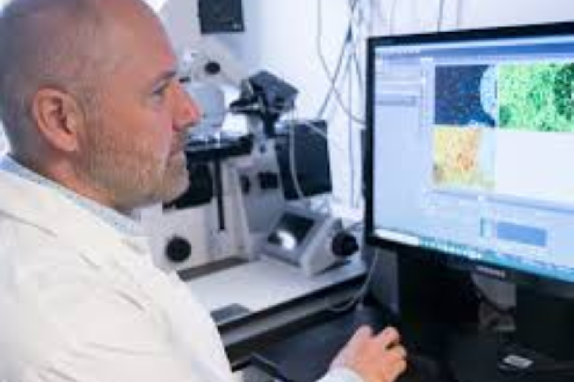 Gene therapy for ARSACS: preclinical studies underway